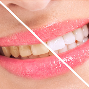 Cosmetic Dentistry
